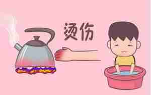 热水烫伤后难受的句子