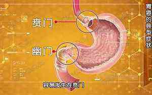 门对门挂五帝钱正确挂法图片(门对)